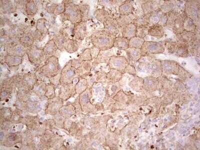 Immunohistochemistry: IDO2 Antibody (OTI11B2) - Azide and BSA Free [NBP2-72454] - Analysis of Human liver tissue. (Heat-induced epitope retrieval by 1 mM EDTA in 10mM Tris, pH8.5, 120C for 3min)