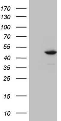 Western Blot: IDO2 Antibody (OTI11B2) - Azide and BSA Free [NBP2-72454] - Analysis of HEK293T cells were transfected with the pCMV6-ENTRY control (Left lane) or pCMV6-ENTRY IDO2.