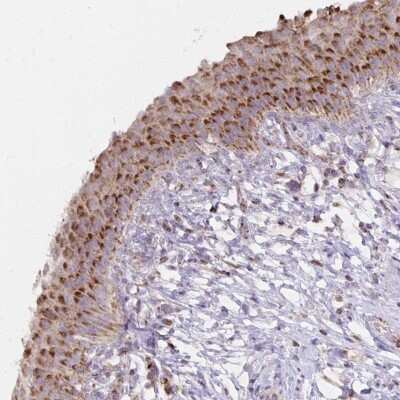 Immunohistochemistry-Paraffin: IER3 Antibody [NBP2-38513] - Staining of human urinary bladder shows distinct cytoplasmic positivity in urothelial cells.