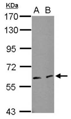 Western Blot: IF3EI Antibody [NBP2-16918] - Sample (50 ug of whole cell lysate) A: mouse brown adipose B: mouse white adipose, 7. 5% SDS PAGE gel, diluted at 1:1000.