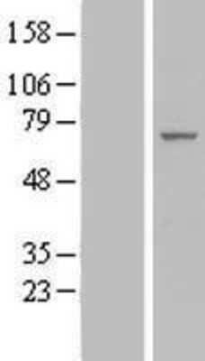 Western Blot: IF3EI Overexpression Lysate (Adult Normal) [NBL1-10193] Left-Empty vector transfected control cell lysate (HEK293 cell lysate); Right -Over-expression Lysate for IF3EI.