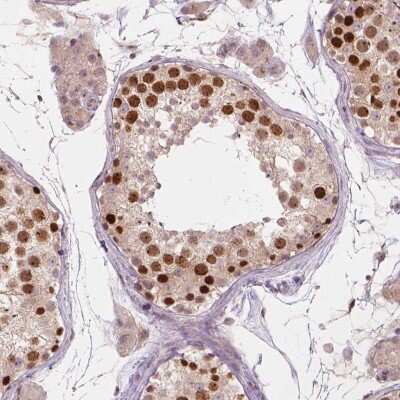 Immunohistochemistry: IFFO Antibody [NBP2-49598] - Staining of human testis shows strong nuclear positivity in cells in seminiferous ducts.