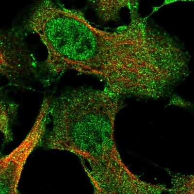 Immunocytochemistry/Immunofluorescence: IFFO2 Antibody [NBP2-57033] - Staining of human cell line U-2 OS shows localization to nucleoplasm & plasma membrane.