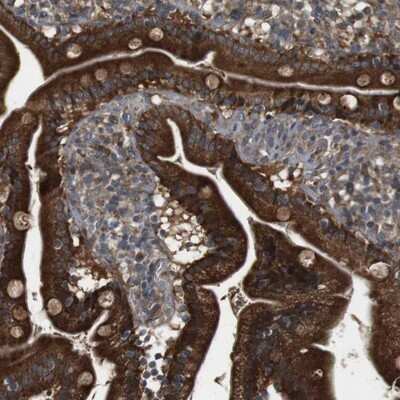 Immunohistochemistry-Paraffin: IFFO2 Antibody [NBP1-91092] - Staining of human duodenum shows strong cytoplasmic positivity in glandular cells.