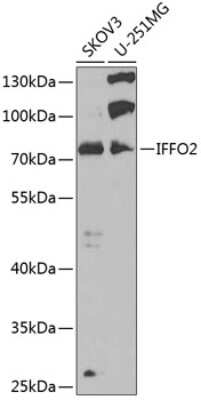 Western Blot: IFFO2 Antibody [NBP3-05222] - Analysis of extracts of various cell lines, using IFFO2 antibody at 1:1000 dilution. Secondary antibody: HRP Goat Anti-Rabbit IgG (H+L) at 1:10000 dilution. Lysates/proteins: 25ug per lane. Blocking buffer: 3% nonfat dry milk in TBST. Detection: ECL Basic Kit