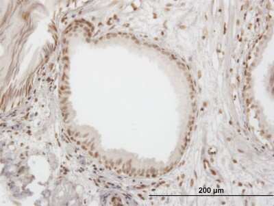 Immunohistochemistry-Paraffin: IFI16 Antibody (5C10) [H00003428-M06] - Analysis of monoclonal antibody to IFI16 on formalin-fixed paraffin-embedded human prostate. Antibody concentration 1.2 ug/ml