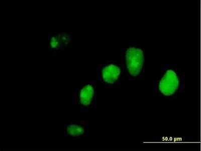 Immunocytochemistry/Immunofluorescence: IFI16 Antibody [H00003428-B01P] - Analysis of purified antibody to IFI16 on HeLa cell. (antibody concentration 10 ug/ml)