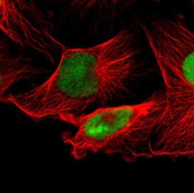 Immunocytochemistry/Immunofluorescence: IFI16 Antibody [NBP1-83118] - Staining of human cell line U-251 MG shows localization to nucleus & nucleoli. Antibody staining is shown in green.