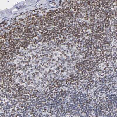 Immunohistochemistry-Paraffin: IFI16 Antibody [NBP1-83118] - Staining of human lymph node shows strong nuclear positivity in non-germinal center cells.