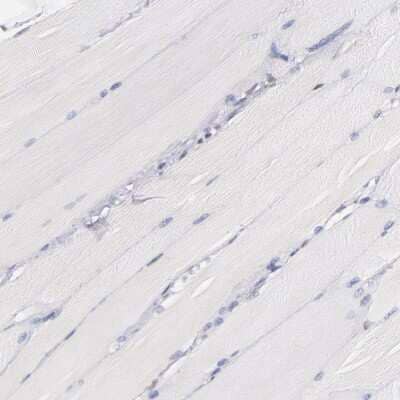 Immunohistochemistry-Paraffin: IFI16 Antibody [NBP1-83118] - Staining of human skeletal muscle shows no positivity in myocytes as expected.