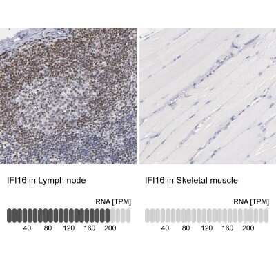 Immunohistochemistry-Paraffin: IFI16 Antibody [NBP1-83118] - Staining in human lymph node and skeletal muscle tissues using NBP1-83118 antibody. Corresponding IFI16 RNA-seq data are presented for the same tissues.