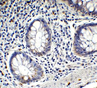 Immunohistochemistry-Paraffin: IFI16 Antibody [NBP3-18336] - Immunohistochemical analysis of paraffin-embedded human testis tissue using anti-IFI16 antibody (NBP3-18336) at 1 ug/mL. Tissue was fixed with formaldehyde and blocked with 10% serum for 1 h at RT; antigen retrieval was by heat mediation with a citrate buffer (pH6). Samples were incubated with primary antibody overnight at 4C. A goat anti-rabbit IgG H&L (HRP) at 1/250 was used as secondary. Counter stained with Hematoxylin.