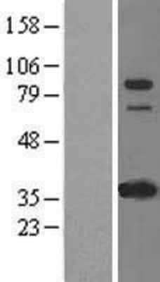 Western Blot IFI16 Overexpression Lysate