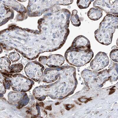 Immunohistochemistry-Paraffin: IFI27 Antibody [NBP1-84745] - Staining of human placenta shows strong granular cytoplasmic positivity in trophoblastic cells.