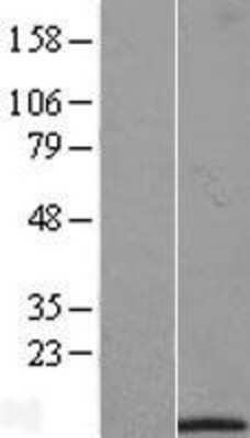 Western Blot IFI27L1 Overexpression Lysate