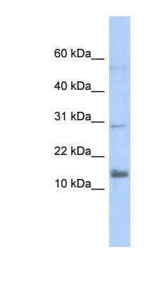 Western Blot IFI27L2 Antibody - BSA Free