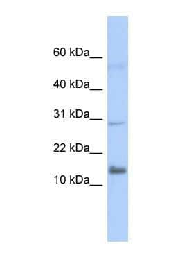 Western Blot: IFI27L2 Antibody [NBP1-69301] - This Anti-FAM14A antibody was used in Western Blot of Transfected 293T   tissue lysate at a concentration of 1ug/ml.