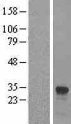 Western Blot: IFI30 Overexpression Lysate (Adult Normal) [NBL1-11828] Left-Empty vector transfected control cell lysate (HEK293 cell lysate); Right -Over-expression Lysate for IFI30.