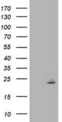 Western Blot: IFI35 Antibody (OTI1C9) - Azide and BSA Free [NBP2-71004] - HEK293T cells were transfected with the pCMV6-ENTRY control (Left lane) or pCMV6-ENTRY IFI35 (Right lane) cDNA for 48 hrs and lysed. Equivalent amounts of cell lysates (5 ug per lane) were separated by SDS-PAGE and immunoblotted with anti-IFI35.