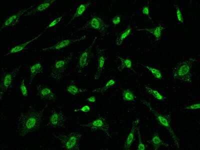 Immunocytochemistry/Immunofluorescence: IFI44 Antibody [NBP2-97510] - Immunofluorescence staining of IFI44 in HeLa cells. Cells were fixed with 4% PFA, permeabilzed with 0.1% Triton X-100 in PBS, blocked with 10% serum, and incubated with rabbit anti-Human IFI44 polyclonal antibody (dilution ratio 1:1000) at 4C overnight. Then cells were stained with the Alexa Fluor(R)488-conjugated Goat Anti-rabbit IgG secondary antibody (green). Positive staining was localized to Nucleus .