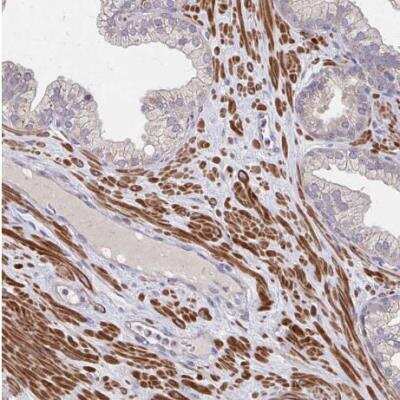 Immunohistochemistry-Paraffin: IFI44L Antibody [NBP2-38892] - Staining of human prostate shows strong cytoplasmic positivity in smooth muscle cells.