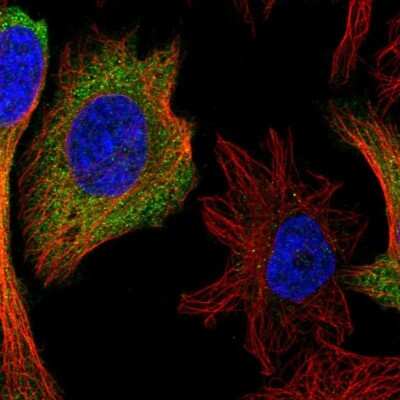 Immunocytochemistry/Immunofluorescence: IFIT1 Antibody [NBP2-33751] - Immunofluorescent staining of human cell line HeLa shows localization to cytosol.