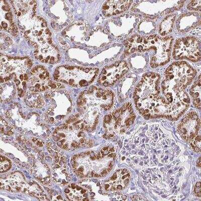 Immunohistochemistry-Paraffin: IFIT1 Antibody [NBP2-33751] - Staining of human kidney shows strong cytoplasmic positivity in renal tubules.