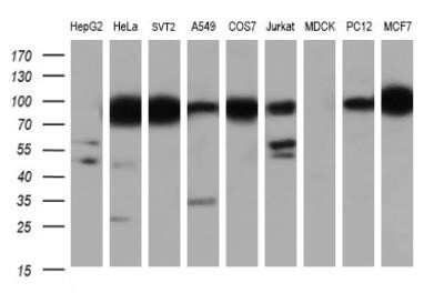 Western Blot: IFIT1 Antibody (OTI3G8) - Azide and BSA Free [NBP2-71005] - Analysis of extracts (35ug) from 9 different cell lines by using anti-IFIT1 monoclonal antibody.