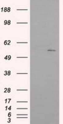 Western Blot: IFIT1 Antibody (OTI3G8) - Azide and BSA Free [NBP2-71005] - HEK293T cells were transfected with the pCMV6-ENTRY control (Left lane) or pCMV6-ENTRY IFIT1 (Right lane) cDNA for 48 hrs and lysed. Equivalent amounts of cell lysates (5 ug per lane) were separated by SDS-PAGE and immunoblotted with anti-IFIT1.