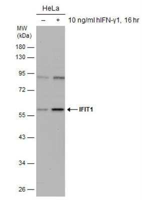 Western Blot: IFIT1 Antibody [NBP2-16921] - Untreated (-) and treated (+) HeLa whole cell extracts (30 ug) were separated by 10% SDS-PAGE, and the membrane was blotted with IFIT1 antibody [N1C1].