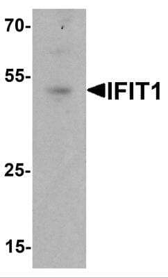 Western Blot: IFIT1 Antibody [NBP2-81823] - Western blot analysis of IFIT1 in rat small intestine tissue lysate with IFIT1 antibody at 1 ug/ml.