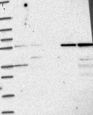 Western Blot: IFIT1 Antibody [NBP3-17870] - Lane 1: Marker [kDa] 250, 130, 95, 72, 55, 36, 28, 17, 10;   Lane 2: RT4;   Lane 3: U-251 MG;   Lane 4: Human Plasma;   Lane 5: Liver;   Lane 6: Tonsil