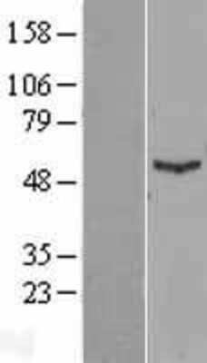 Western Blot IFIT1 Overexpression Lysate