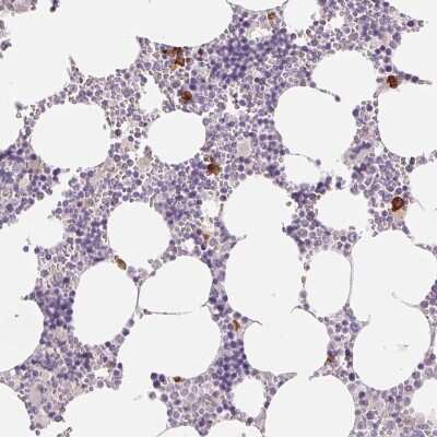 Immunohistochemistry: IFIT1B Antibody [NBP2-38978] - Staining of human bone marrow shows strong cytoplasmic positivity in a subset of hematopoietic cells.