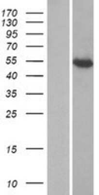 Western Blot: IFIT1B Overexpression Lysate (Adult Normal) [NBP2-08779] Left-Empty vector transfected control cell lysate (HEK293 cell lysate); Right -Over-expression Lysate for IFIT1B.