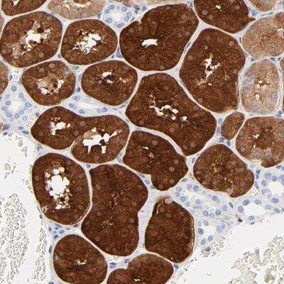 Immunohistochemistry-Paraffin: IFIT2 Antibody [NBP1-85617] - Staining of human kidney shows strong cytoplasmic positivity in cells in tubules.