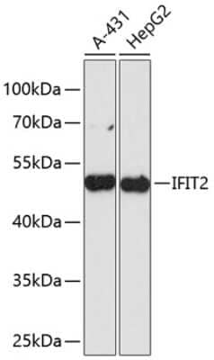 Western Blot: IFIT2 Antibody [NBP3-04917] - Analysis of extracts of various cell lines, using IFIT2 antibody at 1:3000 dilution. Secondary antibody: HRP Goat Anti-Rabbit IgG (H+L) at 1:10000 dilution. Lysates/proteins: 25ug per lane. Blocking buffer: 3% nonfat dry milk in TBST. Detection: ECL Basic Kit