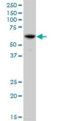 Western Blot: IFIT3 Antibody [H00003437-B01P] - Analysis of IFIT3 expression in A-431.