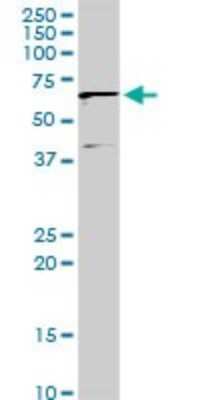 Western Blot: IFIT3 Antibody [H00003437-D01P] - Analysis of IFIT3 expression in human spleen.