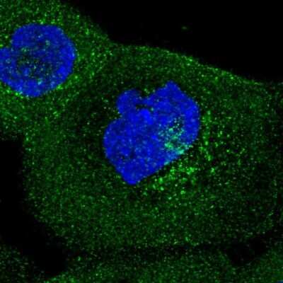 Immunocytochemistry/Immunofluorescence: IFIT5 Antibody [NBP2-56869] - Staining of human cell line A-431 shows localization to plasma membrane & vesicles.