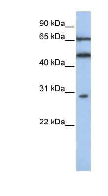 Western Blot: IFIT5 Antibody [NBP1-58886] - Titration: 0.2-1 ug/ml, Positive Control: Jurkat cell lysate.