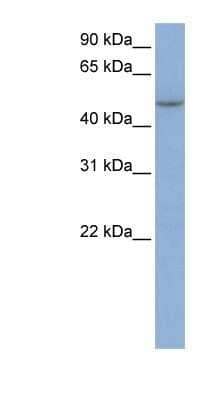 Western Blot: IFIT5 Antibody [NBP1-58887] - MCF-7 whole cell lysates, concentration 0.2-1 ug/ml.