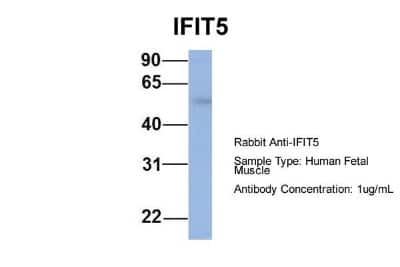 Western Blot IFIT5 Antibody