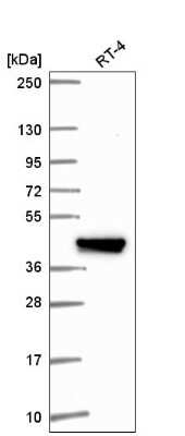 Western Blot IFIT5 Antibody