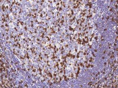 Immunohistochemistry-Paraffin: IFITM1 Antibody (001) [NBP2-89229] - Staining of human IFITM1 in human tonsil with rabbit monoclonal antibody (1:200).