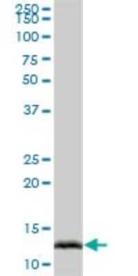 Western Blot: IFITM2 Antibody [H00010581-B01P] - Analysis of IFITM2 expression in human placenta.