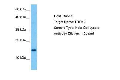 Western Blot: IFITM2 Antibody [NBP2-82255] - Host: Rabbit. Target Name: IFITM2. Sample Tissue: Human Hela Whole Cell lysates. Antibody Dilution: 1ug/ml