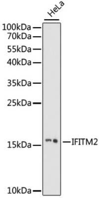 Western Blot: IFITM2 Antibody [NBP3-03909] - Analysis of extracts of HeLa cells, using IFITM2 antibody at 1:1000 dilution. Secondary antibody: HRP Goat Anti-Rabbit IgG (H+L) at 1:10000 dilution. Lysates/proteins: 25ug per lane. Blocking buffer: 3% nonfat dry milk in TBST. Detection: ECL Basic Kit .