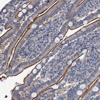 Immunohistochemistry IFITM5 Antibody