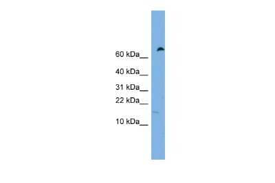 Western Blot IFITM5 Antibody - BSA Free